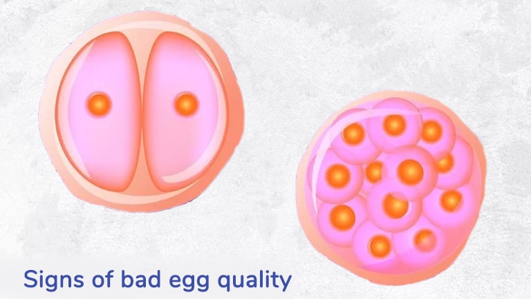 Signs of Poor Egg Quality - Unveiling Symptoms and Causes