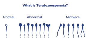 Fertility Articles 1 What is Teratozoospermia? A Detailed Guide to Understanding Causes and Symptoms