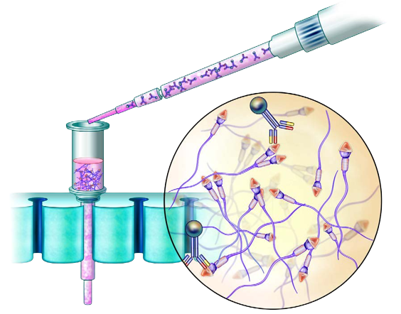 MACS (Magnetic Activated Cell Sorting)