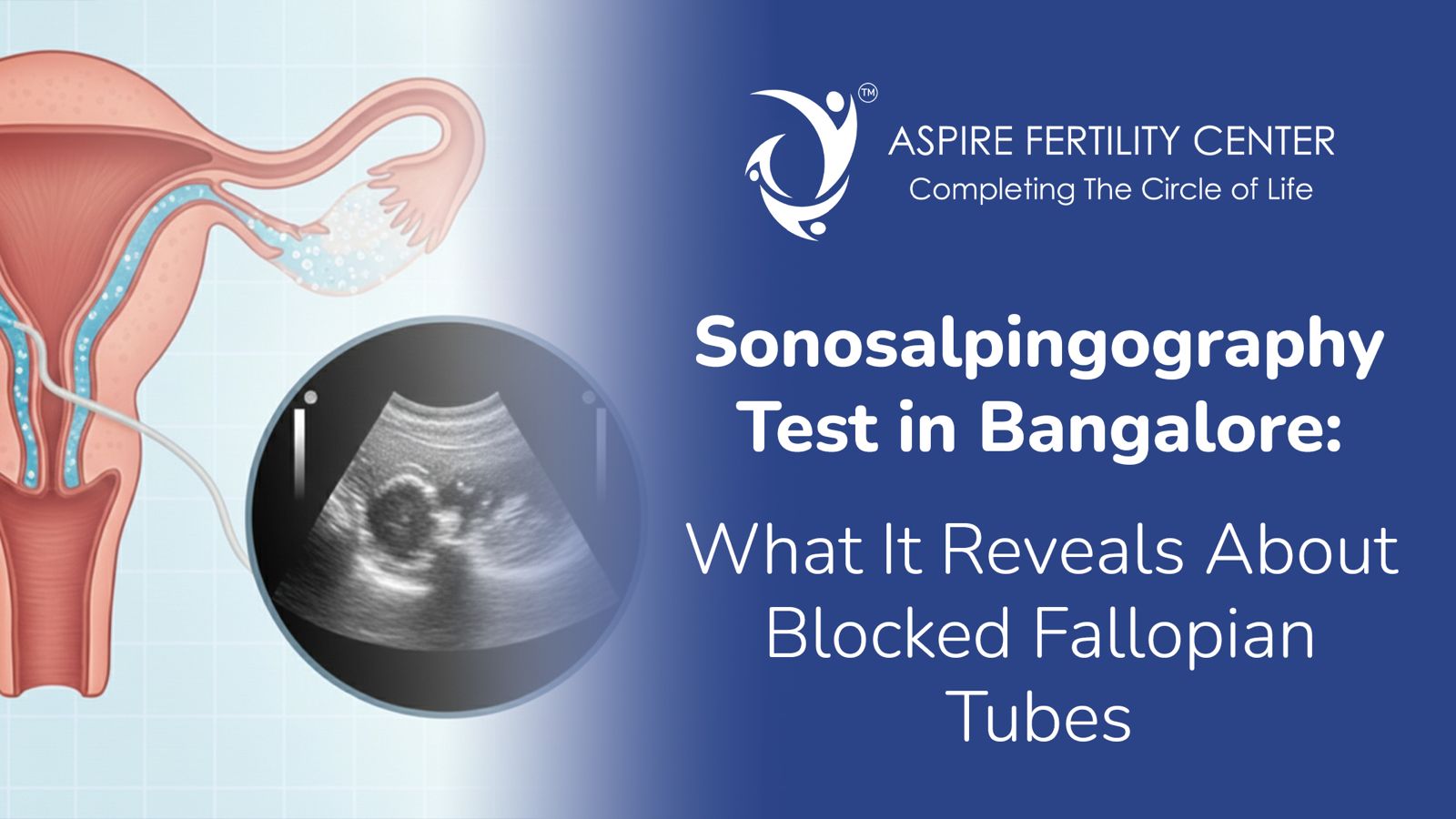 Sonosalpingography Test in Bangalore: What It Reveals About Blocked Fallopian Tubes Sonosalpingography Test in Bangalore